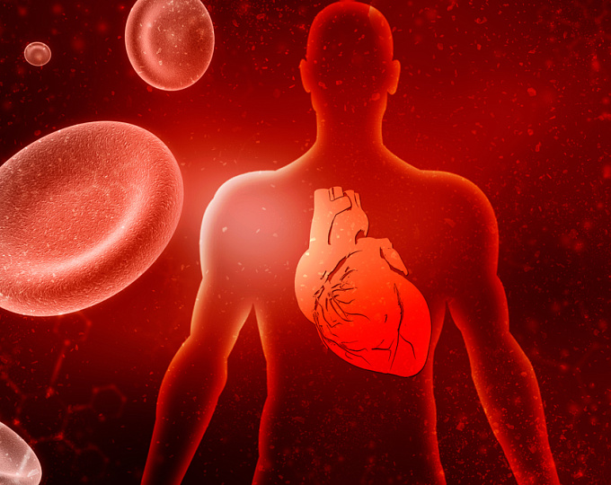 Атеромы коронарных артерий на КТ сердца