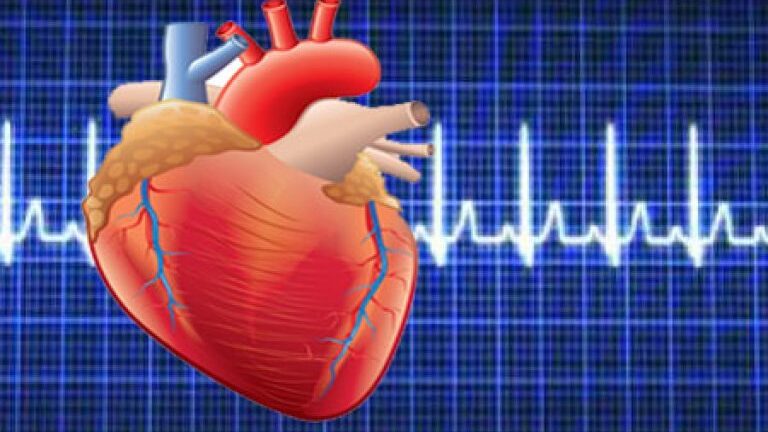 Аритмия сердца: причины и способы лечения