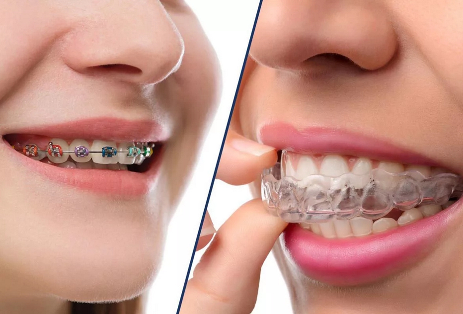 Что предлагает современная стоматология