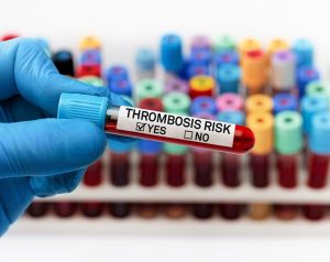 Риск рецидива тромбоза после прекращения приема антикоагулянтов у пациентов с онкологическими заболеваниями