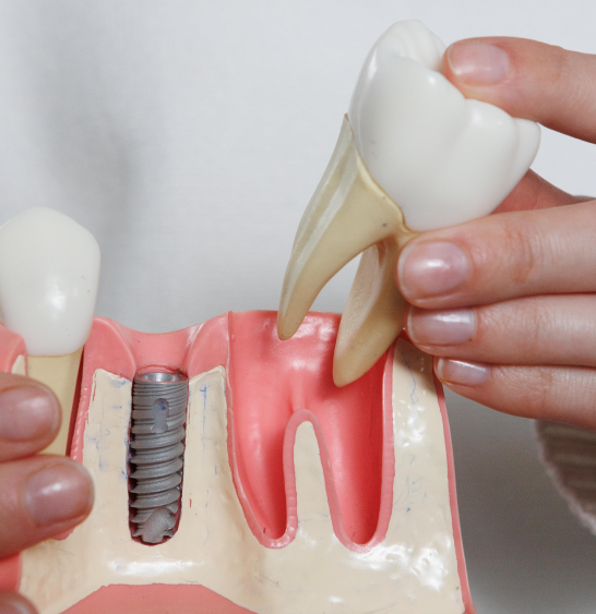 Почему важно регулярно посещать стоматолога перед плановым удалением зуба
