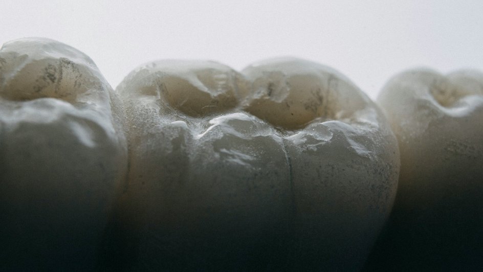 Circulation: бактерия полости рта P. gingivalis может вызвать проблемы с сердцем