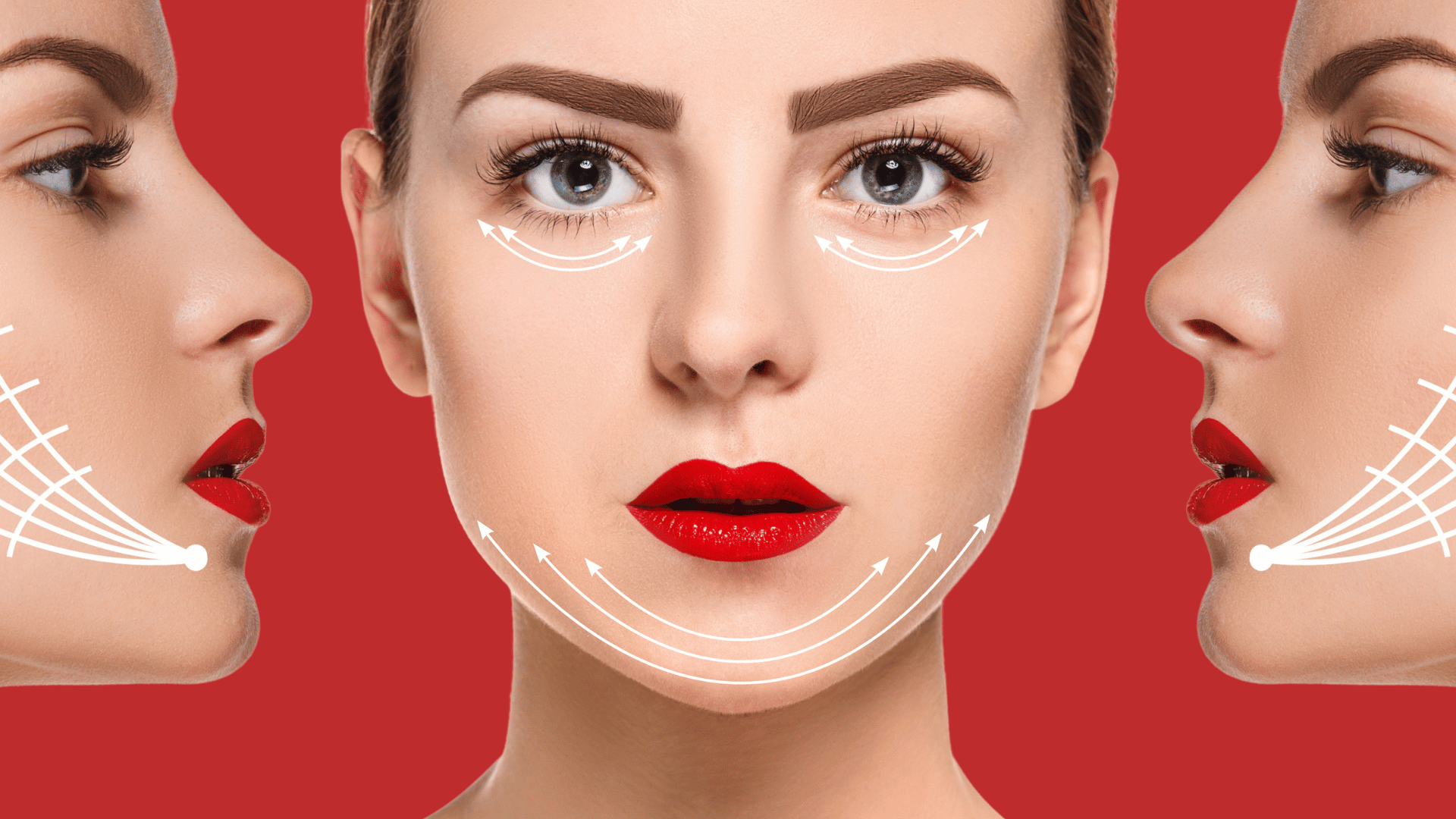 Нитевой лифтинг против гравитационного птоза: когда он действительно нужен